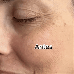 SERUM DE SALMÓN
